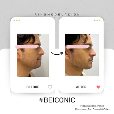 Slider image (4) ICONIC Medical Aesthetic
